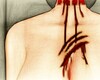 Bleeding wound