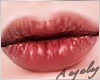 A | Welles dry lips