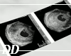 Ultrasound Photos 02