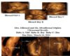Blessed 4D Ultrasound