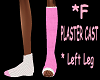 Plaster Cast *Lfoot *F