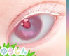 Kids Albino Eyes