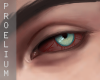 P. Bloodshot eyes> Left