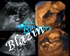 My ultrasound