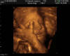 ~PK~ Cyan's ultrasound