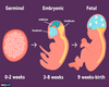 Fetal Poster