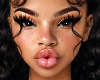 Kiss MH