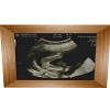 ultrasound girl