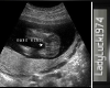 Baby Girl Ultrasound