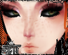 :ginger rage