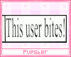 bites