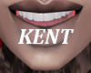 PERFECT VENEERS