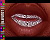 †. M Teeth 11