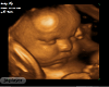 Baby Dj Ultrasound