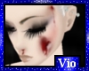 VIO Bloody Wounded Skin2