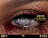 |< Zombie! Decomposed!