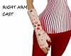 ARM CAST-RIGHT