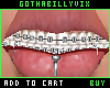 Mouth Braces Addon