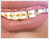 MRC Adult Dental Braces
