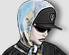 broken cap