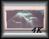 4K Baby Scan Photo Pink