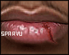s. Asteri Scar lips