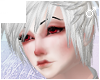 |U.K| Sickly Skin