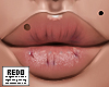 chapped lips; rose