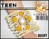 TEEN SunSine Bracelet R