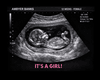 Ambyer Banks Sonogram