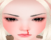 Nose Bleed Skin