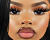 Skye MH
