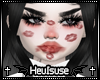 H. too much kisses
