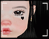 kid H