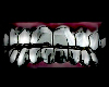 (F) chrome on my teeth !