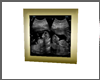 Twins Ultrasound Pic