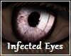 Infected Eyes