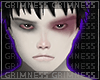 ✮ Hurted boy