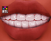 †. Teeth 77