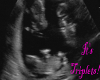 Female Triplet Ultrasoun