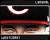 "WC.Anthony Lite Skin"