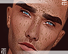 TC. Freckles