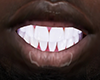 M| White Teeth v1
