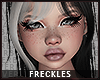 🍓Juicy-Freckles