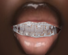 diamond braces
