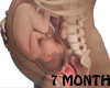 Ǝ/7 Month Fetus