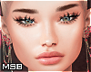 B | Vien MH V1