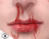 Marks Lips K.O