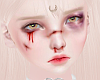 Hurt Skin