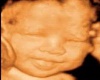 Shani Ultrasound Pic